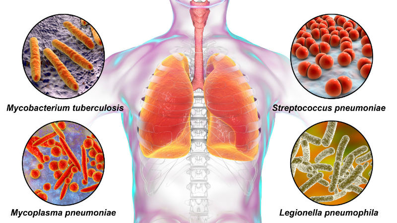 Legionella Risk Assessment Near Me Legionella Risk Assessment Near Me